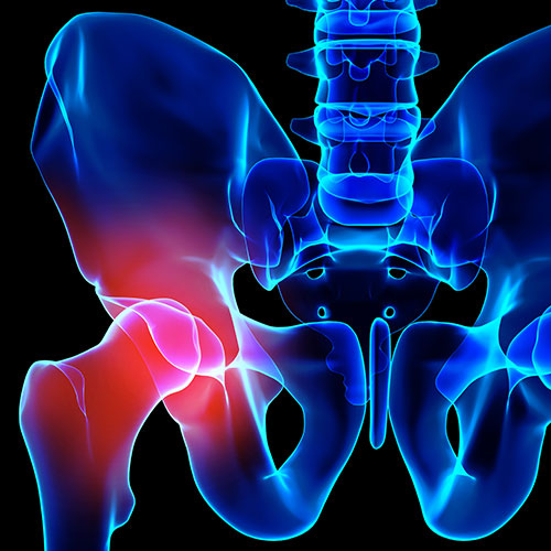 Bones and Joints